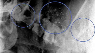 Fragments of lead in a hunter-shot feral pig